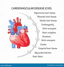 Cardiovascular Disease Risk Prediction